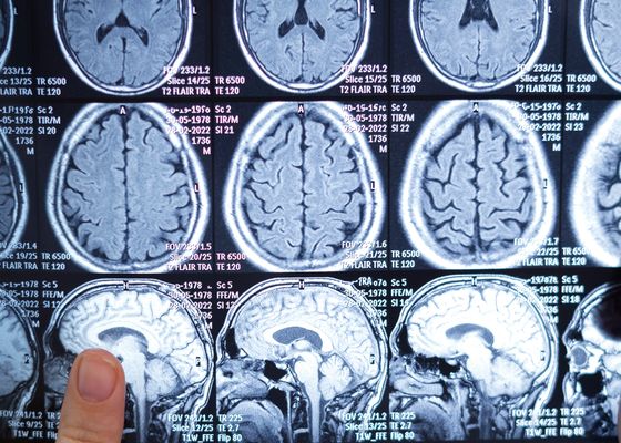 El truco para saber la velocidad a la que envejecerá tu cuerpo