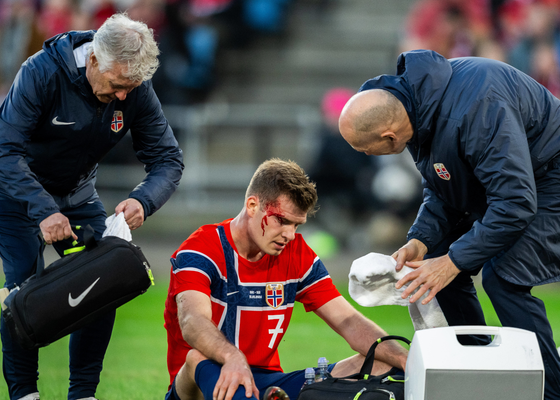 Sorloth se retira con un golpe en la cabeza antes de volver al Atlético de Madrid