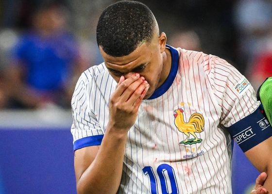 Alarma por la lesión de Mbappé: tiene que ser operado