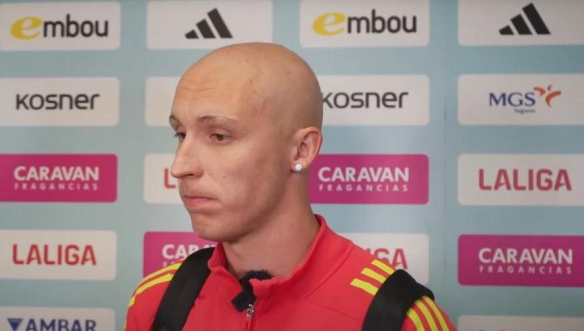 Valery explica lo de nuevo aspecto: "Tengo alopecia areata"