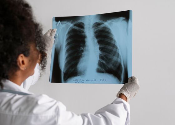 Un antes y un después contra el cáncer de pulmón